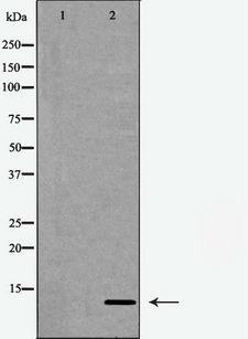 CKS1B / CKS1 Antibody - Western blot analysis of extracts of Jurkat cells, treated with serum (20%, 15mins) using CKS1 antibody. The lane on the left is treated with the antigen-specific peptide.
