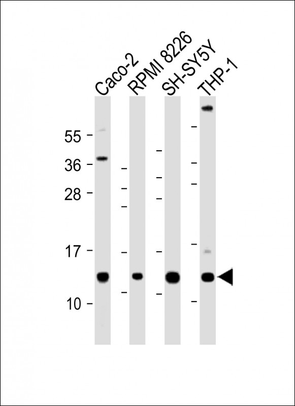 CKS2 Antibody - All lanes: Anti-CKS2 Antibody (C-Term) at 1:2000 dilution Lane 1: Caco-2 whole cell lysate Lane 2: RPMI 8226 whole cell lysate Lane 3: SH-SY5Y whole cell lysate Lane 4: THP-1 whole cell lysate Lysates/proteins at 20 µg per lane. Secondary Goat Anti-Rabbit IgG, (H+L), Peroxidase conjugated at 1/10000 dilution. Predicted band size: 10 kDa Blocking/Dilution buffer: 5% NFDM/TBST.