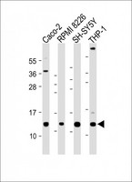 CKS2 Antibody - All lanes: Anti-CKS2 Antibody (C-Term) at 1:2000 dilution Lane 1: Caco-2 whole cell lysate Lane 2: RPMI 8226 whole cell lysate Lane 3: SH-SY5Y whole cell lysate Lane 4: THP-1 whole cell lysate Lysates/proteins at 20 µg per lane. Secondary Goat Anti-Rabbit IgG, (H+L), Peroxidase conjugated at 1/10000 dilution. Predicted band size: 10 kDa Blocking/Dilution buffer: 5% NFDM/TBST.