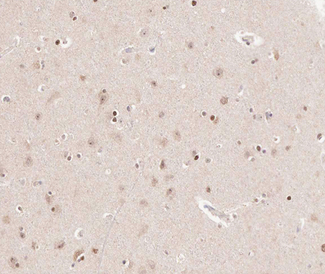 CKS2 Antibody - 1:100 staining human brain tissue by IHC-P. The tissue was formaldehyde fixed and a heat mediated antigen retrieval step in citrate buffer was performed. The tissue was then blocked and incubated with the antibody for 1.5 hours at 22°C. An HRP conjugated goat anti-rabbit antibody was used as the secondary.
