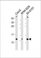 CKS2 Antibody - All lanes: Anti-CKS2 Antibody (N-Term) at 1:2000 dilution Lane 1: Caco2 whole cell lysate Lane 2: RPMI 8226 whole cell lysate Lane 3: SH-SY5Y whole cell lysate Lysates/proteins at 20 µg per lane. Secondary Goat Anti-Rabbit IgG, (H+L), Peroxidase conjugated at 1/10000 dilution. Predicted band size: 10 kDa Blocking/Dilution buffer: 5% NFDM/TBST.
