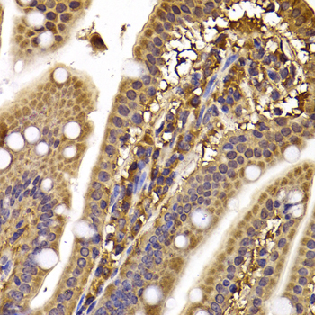 CLASP1 Antibody - Immunohistochemistry of paraffin-embedded mouse ileum tissue.