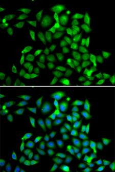 CLASP1 Antibody - Immunofluorescence analysis of A549 cells.