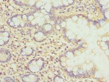 CLASP1 Antibody - Immunohistochemistry of paraffin-embedded human small intestine at dilution 1:100