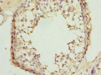 CLASP1 Antibody - Immunohistochemistry of paraffin-embedded human testis tissue at dilution 1:100