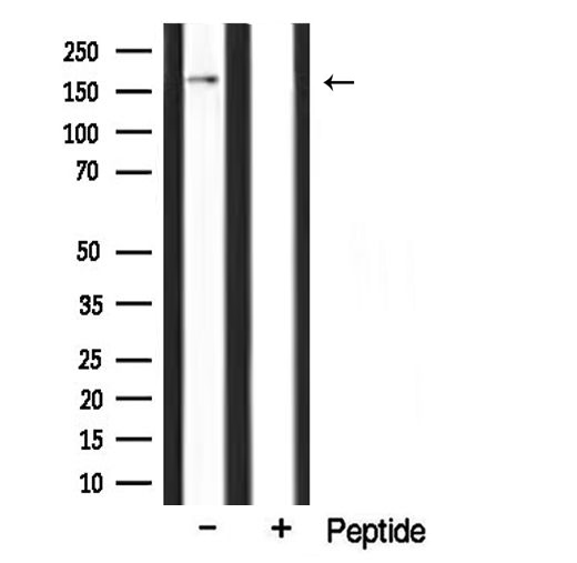 CLASP1 Antibody - Western blot analysis of extracts of mouse brain tissue using CLASP1 antibody.