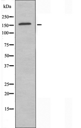 CLASP1 Antibody - Western blot analysis of extracts of Jurkat cells using CLASP1 antibody.