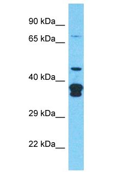 CLASP2 Antibody - CLASP2 antibody Western Blot of Jurkat. Antibody dilution: 1 ug/ml.  This image was taken for the unconjugated form of this product. Other forms have not been tested.