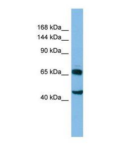 CLASP2 Antibody - Western blot of Human HT1080 . CLASP2 antibody dilution 1.0 ug/ml.  This image was taken for the unconjugated form of this product. Other forms have not been tested.