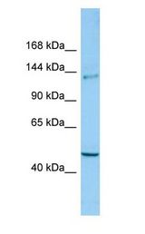 CLASP2 Antibody - CLASP2 antibody Western Blot of ACHN.  This image was taken for the unconjugated form of this product. Other forms have not been tested.