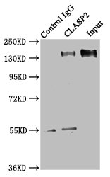 CLASP2 Antibody - Immunoprecipitating CLASP2 in HEK293 whole cell lysate Lane 1: Rabbit control IgG instead of CLASP2 Antibody in HEK293 whole cell lysate.For western blotting, a HRP-conjugated Protein G antibody was used as the secondary antibody (1/2000) Lane 2: CLASP2 Antibody (8µg) + HEK293 whole cell lysate (500µg) Lane 3: HEK293 whole cell lysate (10µg)