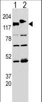 CLASP2 Antibody - Western blot of CLASP (arrow) using rabbit polyclonal CLASP Antibody (Y1019). 293 cell lysates transfected with the ACADL gene (Lane 1) and with the GFP-CLASP (Lane 2).