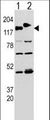 CLASP2 Antibody - Western blot of CLASP (arrow) using rabbit polyclonal CLASP Antibody (Y1019). 293 cell lysates transfected with the ACADL gene (Lane 1) and with the GFP-CLASP (Lane 2).