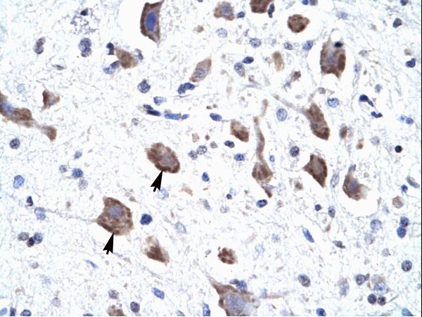 ClC-3 / CLCN3 Antibody - CLCN3 antibody ARP35504_T100-NP_776297-CLCN3 (chloride channel 3) Antibody was used in IHC to stain formalin-fixed, paraffin-embedded human brain.  This image was taken for the unconjugated form of this product. Other forms have not been tested.