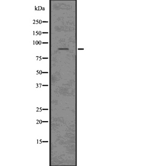 ClC-3 / CLCN3 Antibody - Western blot analysis of CLCN3 using HepG2 whole cells lysates