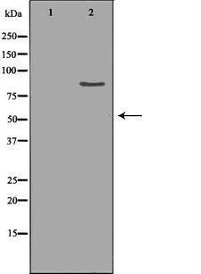 ClC-5 / CLCN5 Antibody - Western blot analysis of HepG2 whole cells lysates using CLCN5 antibody. The lane on the left is treated with the antigen-specific peptide.
