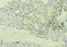 ClC-5 / CLCN5 Antibody - 1:100 staining mouse kidney tissue by IHC-P. The sample was formaldehyde fixed and a heat mediated antigen retrieval step in citrate buffer was performed. The sample was then blocked and incubated with the antibody for 1.5 hours at 22°C. An HRP conjugated goat anti-rabbit antibody was used as the secondary.