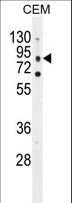 CLC-7 / CLCN7 Antibody - CLCN7 Antibody western blot of CEM cell line lysates (35 ug/lane). The CLCN7 antibody detected the CLCN7 protein (arrow).