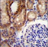 CLC-7 / CLCN7 Antibody - CLCN7 Antibody immunohistochemistry of formalin-fixed and paraffin-embedded human kidney tissue followed by peroxidase-conjugated secondary antibody and DAB staining.