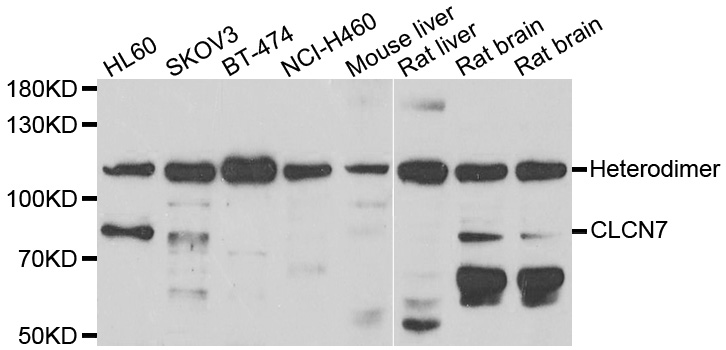 CLC-7 / CLCN7 Antibody - Western blot analysis of extracts of various cell lines.
