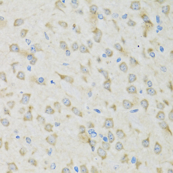 CLC-7 / CLCN7 Antibody - Immunohistochemistry of paraffin-embedded mouse brain tissue.