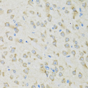 CLC-7 / CLCN7 Antibody - Immunohistochemistry of paraffin-embedded mouse brain tissue.