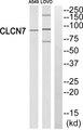 CLC-7 / CLCN7 Antibody - Western blot analysis of extracts from A549 cells and LOVO cells, using CLCN7 antibody.