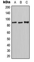 CLC-7 / CLCN7 Antibody - Western blot analysis of CLCN7 expression in HeLa (A); mouse liver (B); rat liver (C) whole cell lysates.
