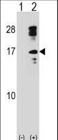 CLC Antibody - Western blot of CLC (arrow) using rabbit polyclonal CLC Antibody. 293 cell lysates (2 ug/lane) either nontransfected (Lane 1) or transiently transfected (Lane 2) with the CLC gene.