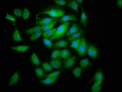 CLC Antibody - Immunofluorescence staining of A549 cells at a dilution of 1:133, counter-stained with DAPI. The cells were fixed in 4% formaldehyde, permeabilized using 0.2% Triton X-100 and blocked in 10% normal Goat Serum. The cells were then incubated with the antibody overnight at 4 °C.The secondary antibody was Alexa Fluor 488-congugated AffiniPure Goat Anti-Rabbit IgG (H+L) .