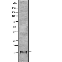CLC Antibody - Western blot analysis of LPPL expression in HEK293 cells. The lane on the left is treated with the antigen-specific peptide.