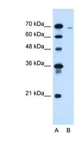 CLCC1 Antibody - CLCC1 antibody ARP44970_T100-NP_001041675-CLCC1(chloride channel CLIC-like 1) Antibody Western blot of HepG2 cell lysate.  This image was taken for the unconjugated form of this product. Other forms have not been tested.