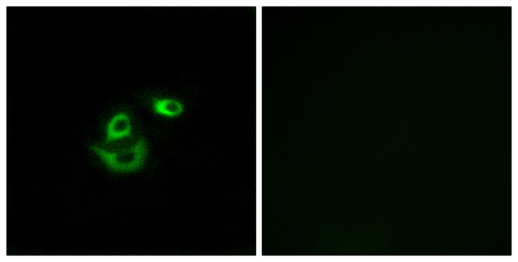 CLCC1 Antibody - Immunofluorescence analysis of A549 cells, using CLCC1 Antibody. The picture on the right is blocked with the synthesized peptide.