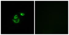 CLCC1 Antibody - Immunofluorescence analysis of A549 cells, using CLCC1 Antibody. The picture on the right is blocked with the synthesized peptide.