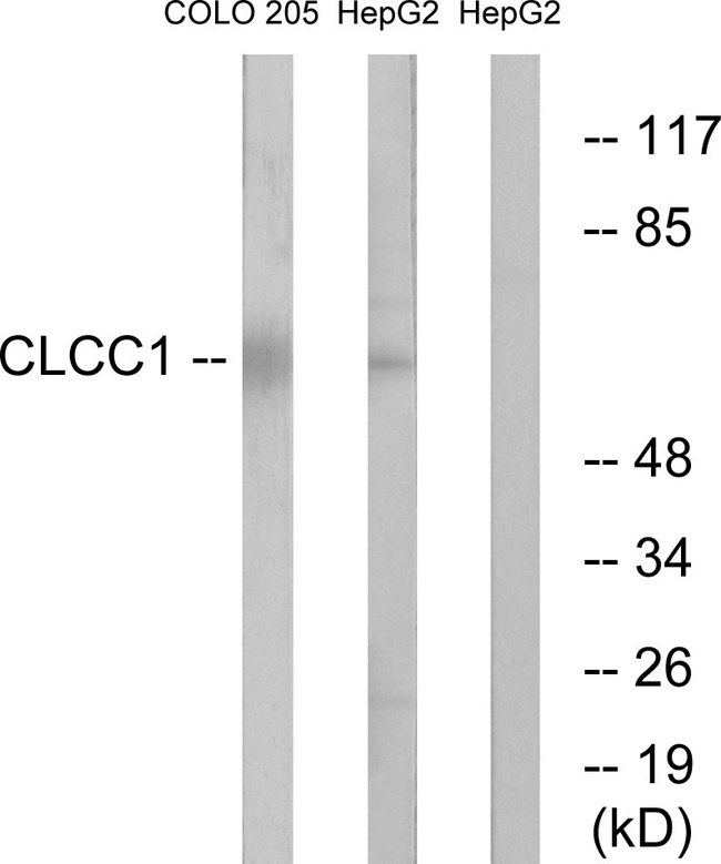 CLCC1 Antibody - Western blot analysis of lysates from COLO and HepG2 cells, using CLCC1 Antibody. The lane on the right is blocked with the synthesized peptide.