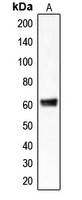 CLCC1 Antibody - Western blot analysis of CLCC1 expression in HepG2 (A) whole cell lysates.