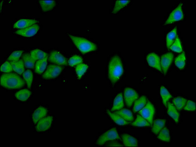 CLCC1 Antibody - Immunofluorescence staining of Hela cells diluted at 1:133, counter-stained with DAPI. The cells were fixed in 4% formaldehyde, permeabilized using 0.2% Triton X-100 and blocked in 10% normal Goat Serum. The cells were then incubated with the antibody overnight at 4°C.The Secondary antibody was Alexa Fluor 488-congugated AffiniPure Goat Anti-Rabbit IgG (H+L).