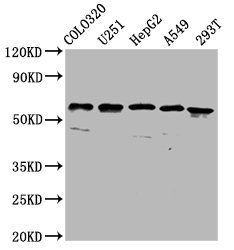 CLCC1 Antibody - Western Blot Positive WB detected in: COLO320 whole cell lysate, U251 whole cell lysate, HepG2 whole cell lysate, A549 whole cell lysate, 293T whole cell lysate All Lanes: CLCC1 antibody at 3.7µg/ml Secondary Goat polyclonal to rabbit IgG at 1/50000 dilution Predicted band size: 63, 57, 48, 40 KDa Observed band size: 63 KDa