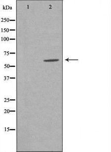CLCC1 Antibody - Western blot analysis of extracts of COLO cells using CLCC1 antibody. The lane on the left is treated with the antigen-specific peptide.