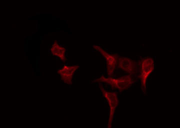 CLCC1 Antibody - Staining COLO205 cells by IF/ICC. The samples were fixed with PFA and permeabilized in 0.1% Triton X-100, then blocked in 10% serum for 45 min at 25°C. The primary antibody was diluted at 1:200 and incubated with the sample for 1 hour at 37°C. An Alexa Fluor 594 conjugated goat anti-rabbit IgG (H+L) Ab, diluted at 1/600, was used as the secondary antibody.