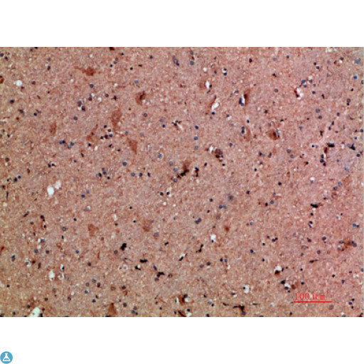 CLCF1 Antibody - Immunohistochemical analysis of paraffin-embedded human-brain, antibody was diluted at 1:200.