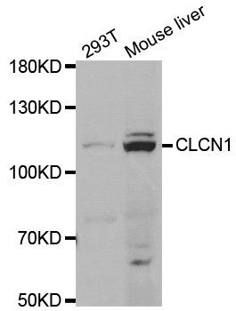 CLCN1 / CLC-1 Antibody - Western blot analysis of extracts of various cell lines.