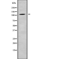 CLCN1 / CLC-1 Antibody - Western blot analysis of CLCN1 using K562 whole cells lysates