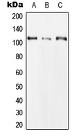CLCN1 / CLC-1 Antibody - Western blot analysis of CLCN1 expression in HeLa (A); NIH3T3 (B); H9C2 (C) whole cell lysates.