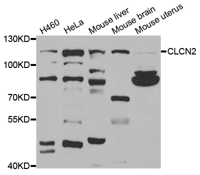 CLCN2 Antibody - Western blot analysis of extracts of various cell lines.