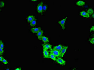 CLCN2 Antibody - Immunofluorescent analysis of HepG2 cells using CLCN2 Antibody at dilution of 1:100 and Alexa Fluor 488-congugated AffiniPure Goat Anti-Rabbit IgG(H+L)