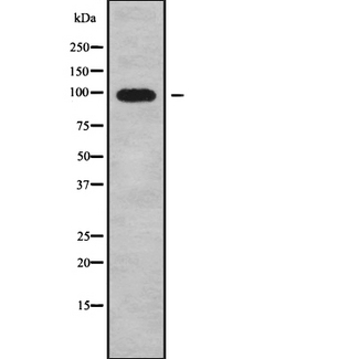CLCN2 Antibody - Western blot analysis of CLCN2 using K562 whole cells lysates