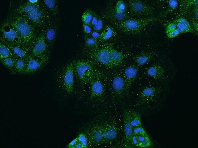 CLCN2 Antibody - Immunofluorescence staining of CLCN2 in CACO2 cells. Cells were fixed with 4% PFA, permeabilzed with 0.1% Triton X-100 in PBS, blocked with 10% serum, and incubated with rabbit anti-Human CLCN2 polyclonal antibody (dilution ratio 1:200) at 4°C overnight. Then cells were stained with the Alexa Fluor 488-conjugated Goat Anti-rabbit IgG secondary antibody (green) and counterstained with DAPI (blue). Positive staining was localized to Cytoplasm.