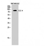 CLCN4 / CLC-4 Antibody - Western blot of CLC-4 antibody