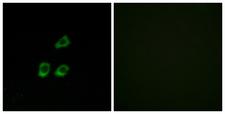 CLCN4 / CLC-4 Antibody - Immunofluorescence analysis of HUVEC cells, using CLCN4 Antibody. The picture on the right is blocked with the synthesized peptide.